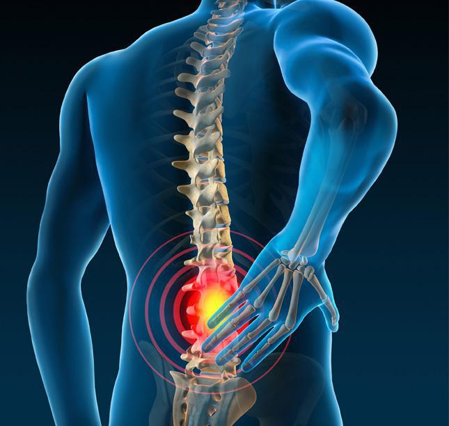 Spinal Cord Stimulation. SAPNA: Spine and Pain Clinic of North America,  Fairfax VA