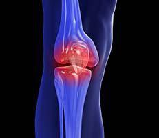 Joint Pain