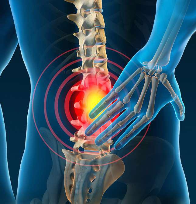 How A Spinal Cord Stimulator Can Alleviate Back Pain